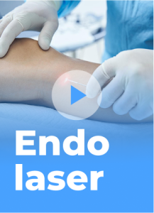 Endolaser